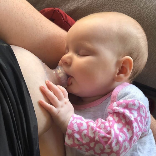 Breastfeeding shield